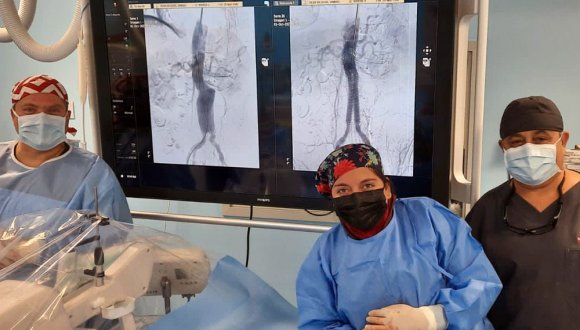 Realizan cirugía de endoprótesis aórtica en sala de hemodinamia del Hospital de Arica Realizan cirugía de endoprótesis aórtica en sala de hemodinamia del Hospital de Arica