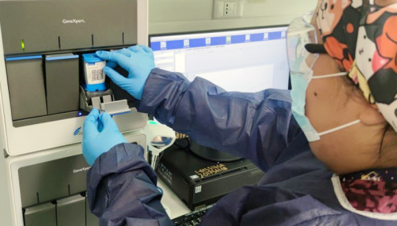 Servicio de Salud Arica hace llamado para que personas pidan examen para descartar tuberculosis